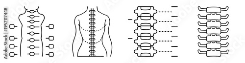 Illustrations of spinal cord anatomy and nerve connections to the body