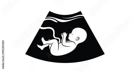 Ultrasound image depicting a fetal position in the womb silhouette