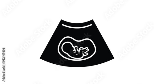 Fetal ultrasound image depicting a developing baby black silhouette