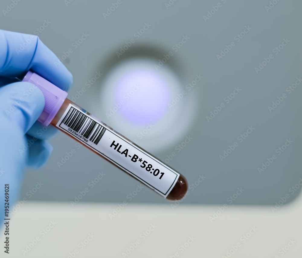 Obraz premium Blood sample tube for HLA-B*58:01 test analysis.