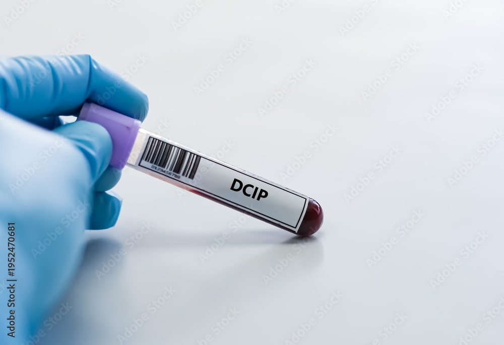Obraz premium Blood sample tube for DCIP viral load test analysis.