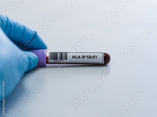 Blood sample tube for HLA-B*58:01 test analysis.