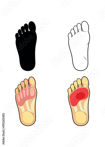 Hand skeleton with highlighted palm joint area and fingers, colored anatomy flat vector illustration