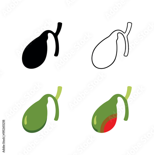 Four flat vector pancreas icons showing dark silhouette, outline, normal yellow texture, and red inflamed tail variant