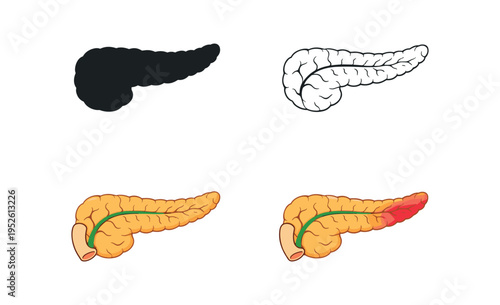 Four flat vector thyroid icons showing black silhouette, outline, dotted normal texture, and central red inflamed area variant