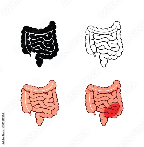 secondary traits include four variants: solid black partial colon, black outline, flesh tone filled colon with appendix, and a variant with the appendix shown red and inflamed. 