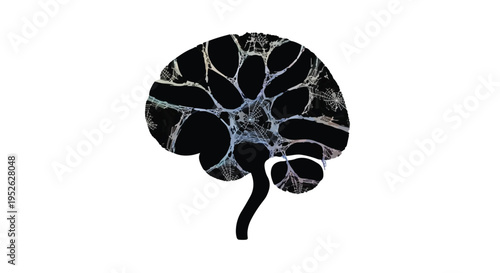 Brain anatomy is visualized through a complex network of interconnected pathways.