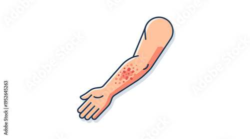 Arm with red rash and spots, flat design medical illustration