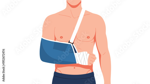 Man stands with his right arm in a blue medical sling and white bandage after an injury for proper healing and support during his recovery.