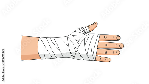 Human hand and wrist are shown with white medical compression bandages wrapped securely to treat a fracture or joint sprain.