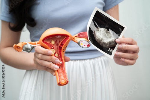 Uterus, Asian, woman holding human anatomy model.