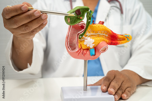 Foto Pancreatitis, pancreatic cancer, Asian doctor with pancreas, gallbladder and bile duct human anatomy model at hospital