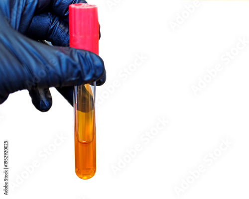 A gloved hand holds an agar slant tube containing solidified medium, illustrating routine microbiology culture handling in a laboratory setting.