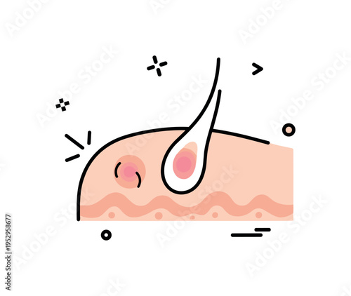 Minor contusion close up showing a rounded skin surface with a subtle gradient bruise and small impact lines nearby, symbolizing tenderness after a bump. The