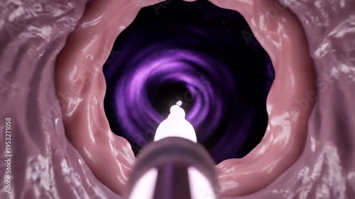 Medical technology endoscopy procedure inside body.