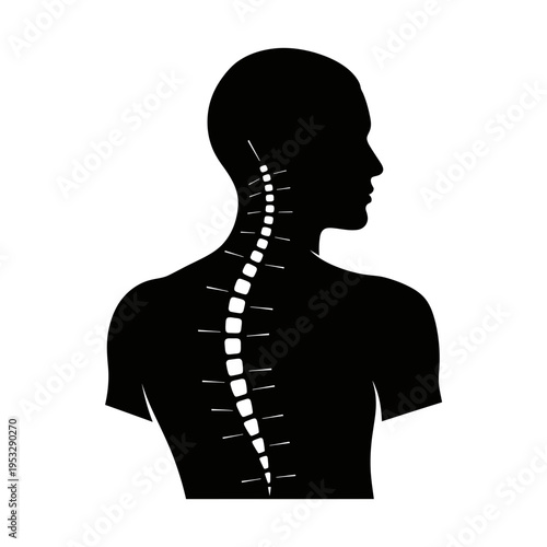 Human silhouette with highlighted spine anatomy.