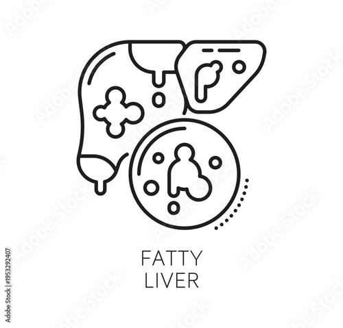 Chronic liver disease and therapy, medical line icon. Human liver with visual indicators for fatty liver disease. Linear vector icon for patient education materials, medical websites, presentation
