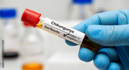 Hand in blue glove holds positive chikungunya test tube with amber liquid image