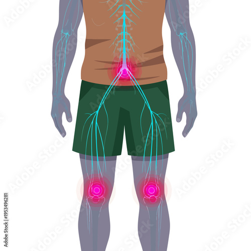 Anatomical Illustration of Human Lower Back and Knee Pain