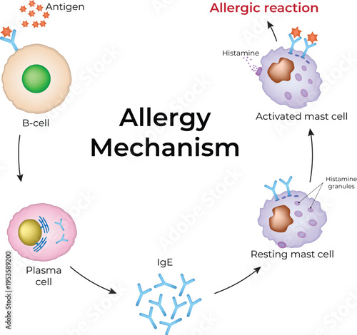 Allergy Mechanism. The allergy cascade process detailing the steps from allergen to IgE to mast cell, and then to histamine release.