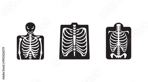 Three black and white xray images of human skeletons on medical files  full body and ribcage views for medical and educational purposes