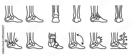 Outline human ankle and foot anatomy, showing various injuries, conditions, and support in a clean, medical illustration style with clear lines
