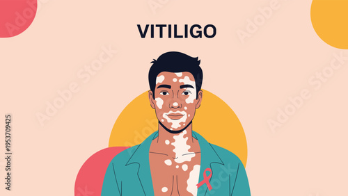 Young man with vitiligo skin condition on his face and chest, featuring a pink ribbon to raise awareness about dermatological health.