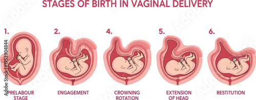 Stages of Birth in Vaginal Delivery Medical Pregnancy and Childbirth Process Vector Illustration