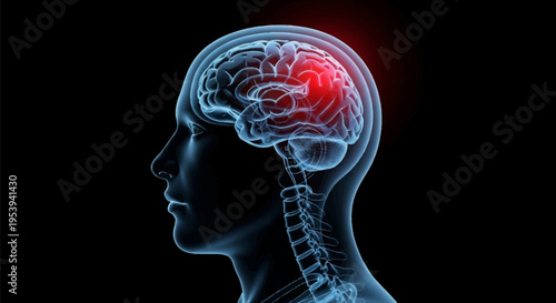 Medical illustration of a human brain with a highlighted area of damage or activity.