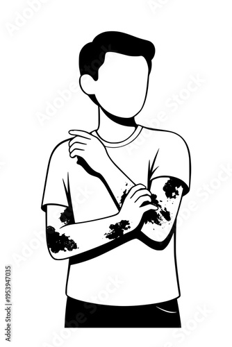 man with skin condition or eczema on arms and elbow