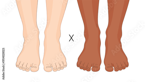 Anatomical cross section illustration of a human finger showing the internal structure and parts of the fingernail bed.