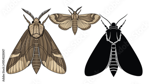 Detailed anatomical medical illustration of the human digestive system including the stomach and intestine structures.