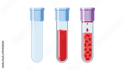 Medical laboratory equipment showing three test tubes for blood analysis including empty vessel and samples with red blood cells.