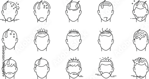 Men hair loss and scalp problems icon set with balding dandruff and treatment stages minimal line vector illustration