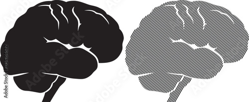 Comparison of human brain hemispheres showing structural differences in outer appearance