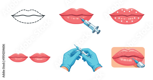 Lip augmentation injection steps and preparation on dark background