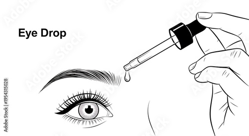 A hand applying eye drops into a woman's eye with a dropper.