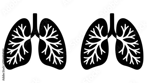 Anatomical illustration of human lungs showing bronchial tree structure in black and white