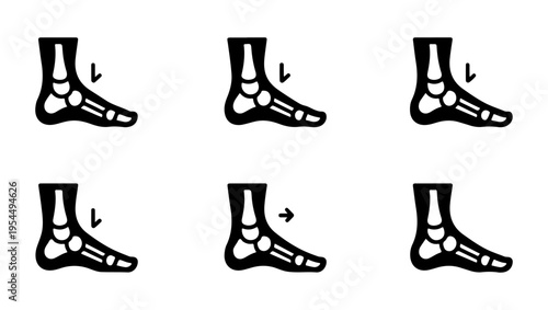 Six skeletal foot illustrations showing different perspectives and angles