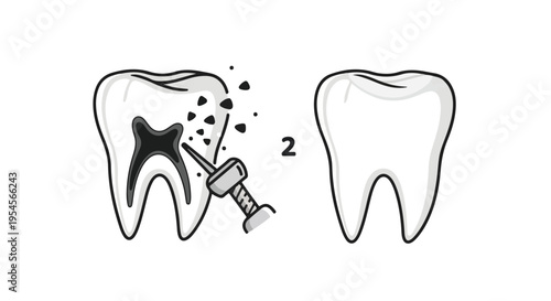 Illustration of a tooth with a dental drill and a healthy tooth side by side on a white background.
