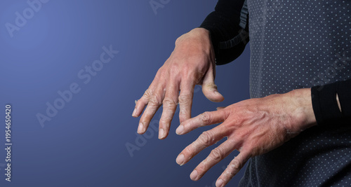 Itchy rash and peeling skin of the hand
