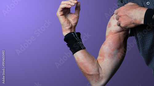 Itchy rash and peeling skin of the arm