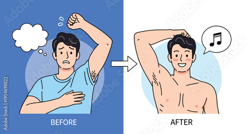 Comparison illustration shows a man before and after armpit hair removal with the latter appearing happy and singing.