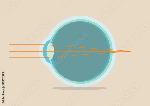 Far-sightedness, illustration