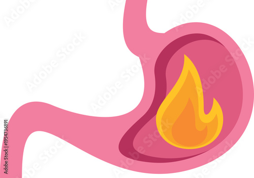 Human stomach experiencing acid reflux with a burning flame inside