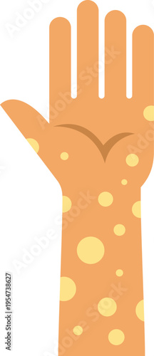 Hand showing signs of allergic reaction or various dermatological conditions on skin