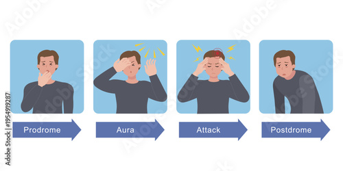 Four Stages of Migraine Progress Infographic Prodrome Aura Attack and Postdrome for Men
