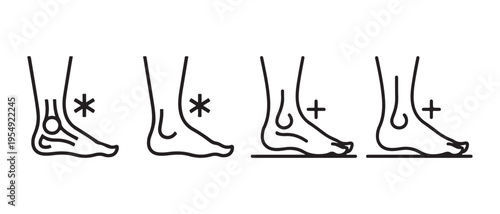 Human Foot Arch Types Line Art Illustration. Normal, High (Cavus), and Flat Feet (Pes Planus) Anatomy.