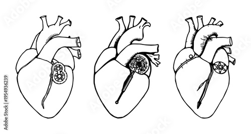 Human heart set with hand-drawn scientific illustration featuring mechanical valves, bioengineering detail, black ink with white background and outlining