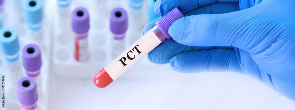 Naklejka premium Doctor holding blood sample tube with PCT test measuring procalcitonin levels for early detection of bacterial infection, sepsis diagnosis and inflammation assessment in modern laboratory medicine